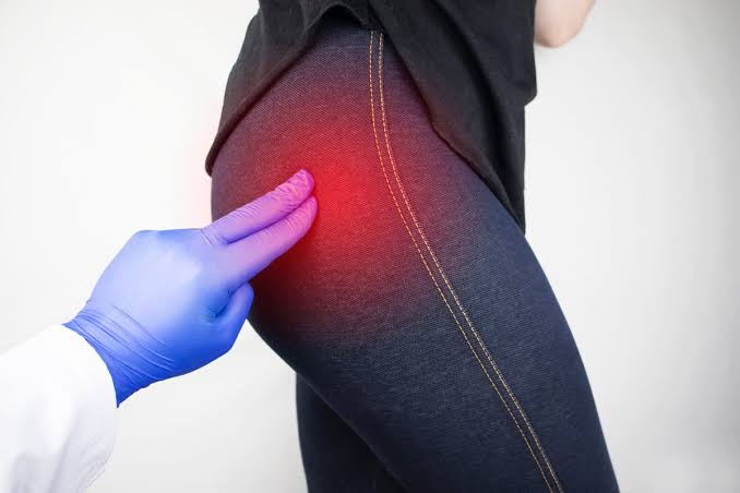 Beyond the Pain Mask: Why a Dedicated Neuro Spinal Hospital Strategy Fixes Chronic Sciatica Long-Term